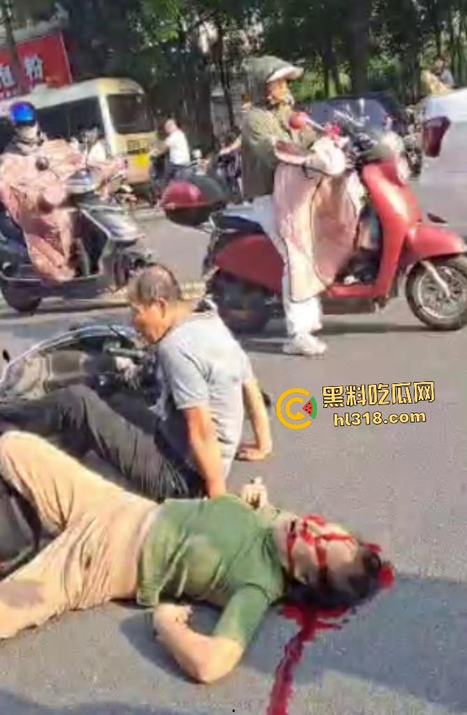 7月20日江西南昌外卖小哥飙车撞翻两个老人倒地不起,绿衣服老头七窍流血,旁边老头直接帮其闭上眼睛!-4
