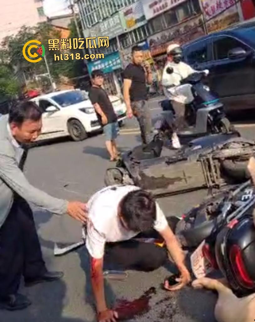 7月20日江西南昌外卖小哥飙车撞翻两个老人倒地不起,绿衣服老头七窍流血,旁边老头直接帮其闭上眼睛!-5