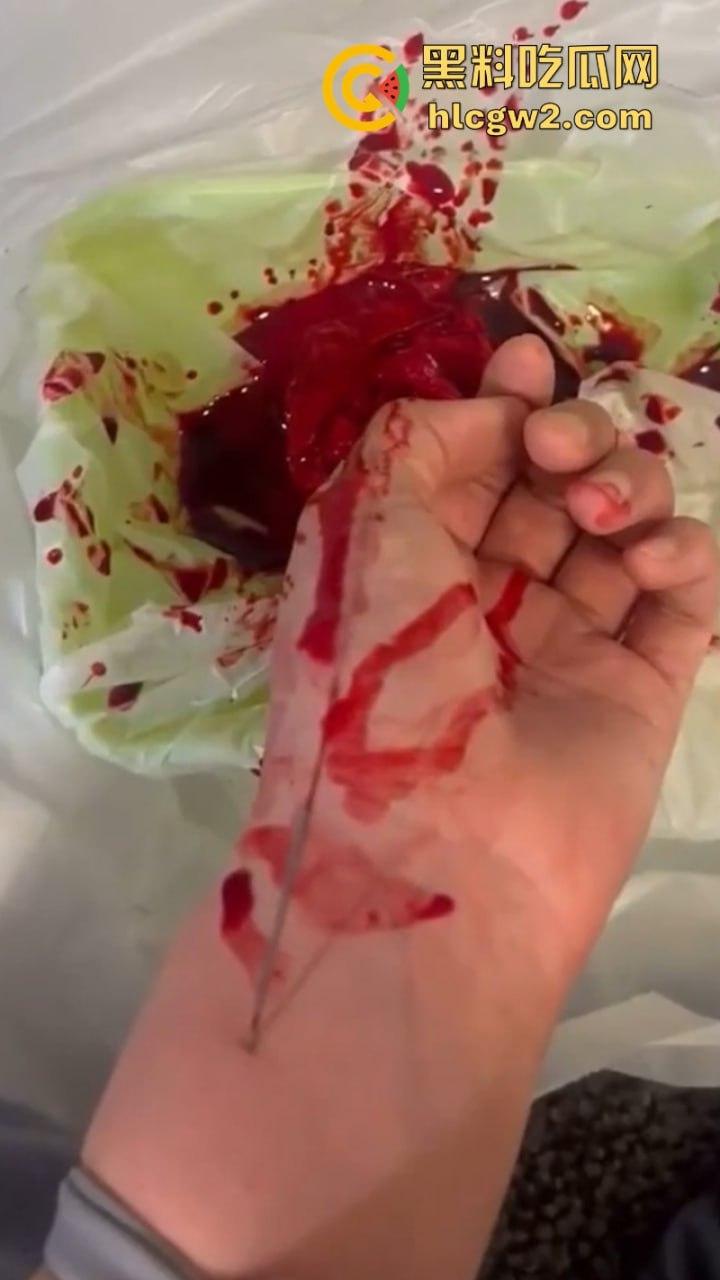 血腥慎入！推特十级脑残血腥自残自拍 残暴割腕引血自流 这是作死还是变态？