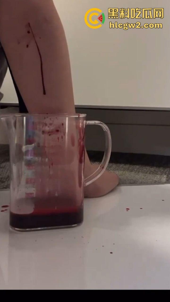 血腥慎入!推特十级脑残血腥自残自拍 残暴割腕引血自流 这是作死还是变态?-4