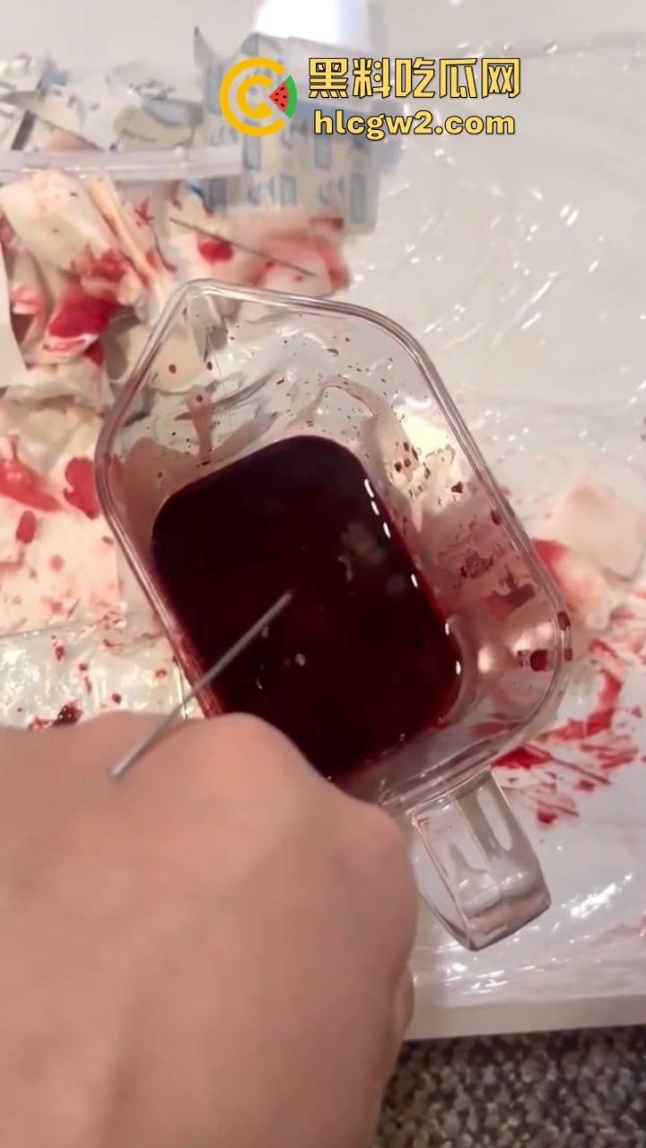 血腥慎入!推特十级脑残血腥自残自拍 残暴割腕引血自流 这是作死还是变态?-9