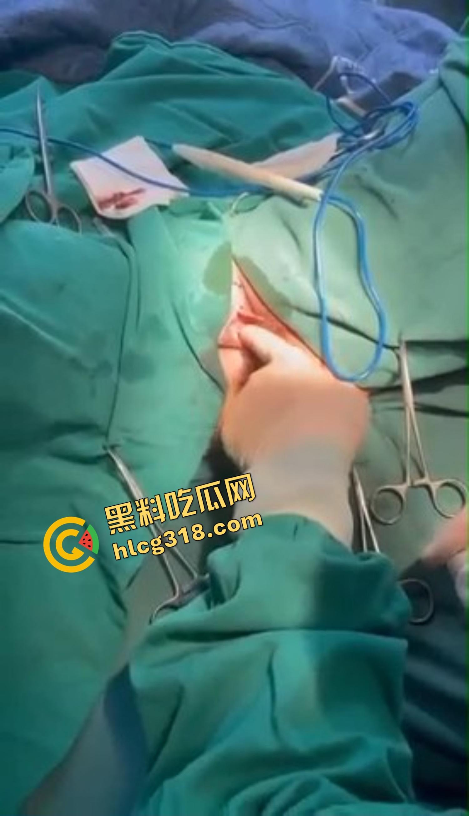 你还以为高端外围豪车天生紧?全靠阴道收缩术收成死夹货,富哥上手就说一根手指进去都得抹油!-7