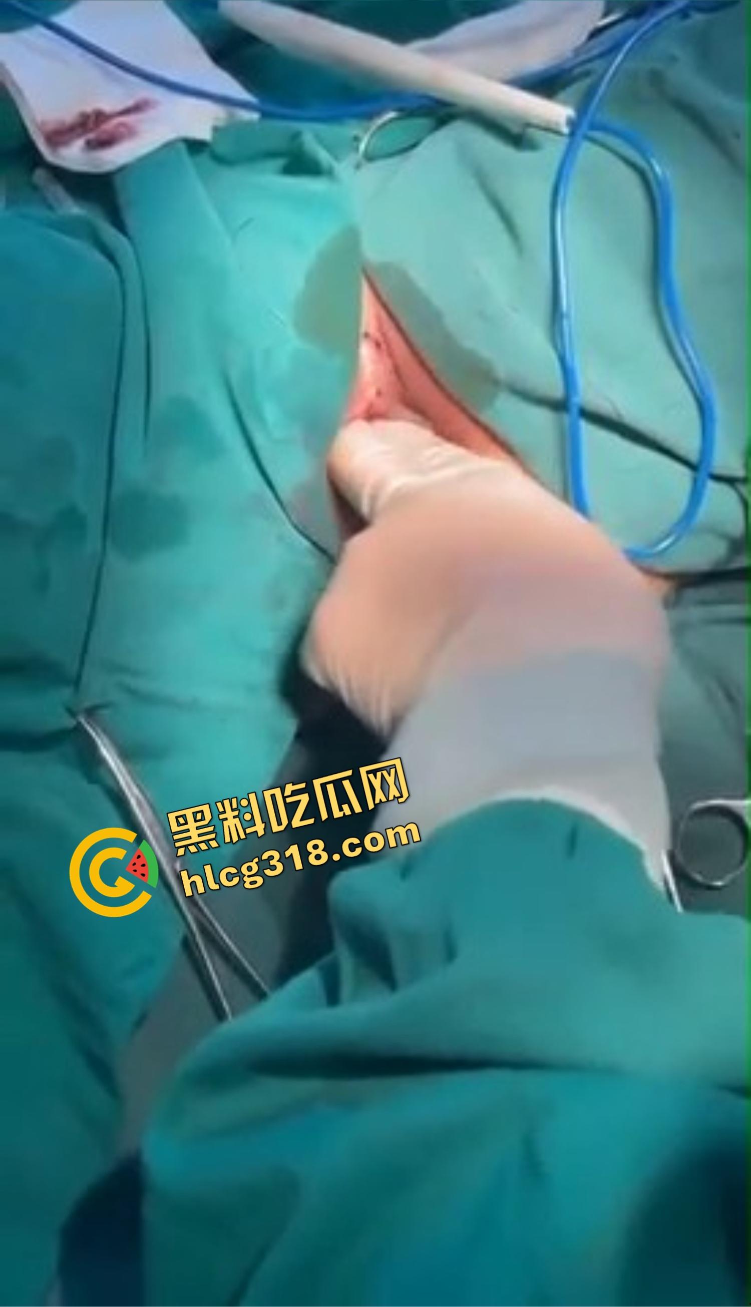 你还以为高端外围豪车天生紧?全靠阴道收缩术收成死夹货,富哥上手就说一根手指进去都得抹油!-10