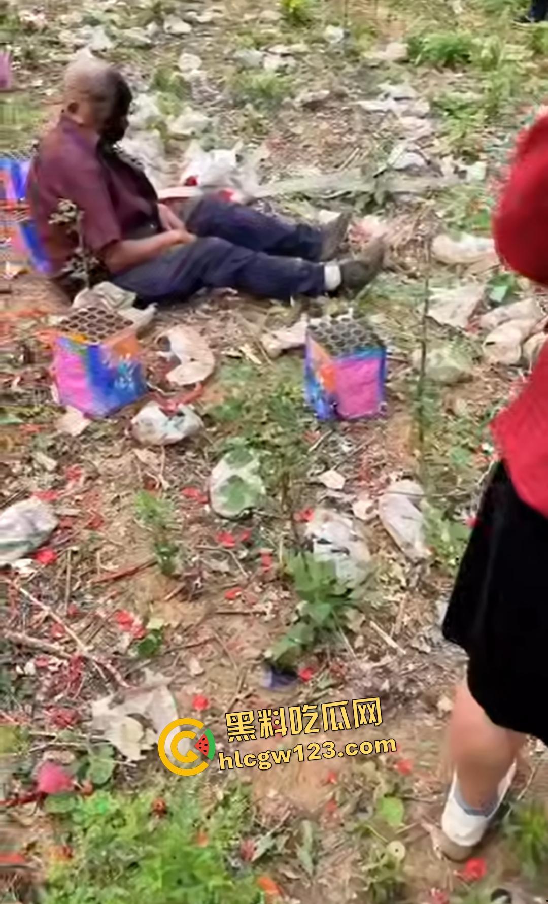 河南平顶山鲁山王大爷捡烟花炸头变黑鬼!右眼已瞎保不住,脑子里有骨头渣!-2