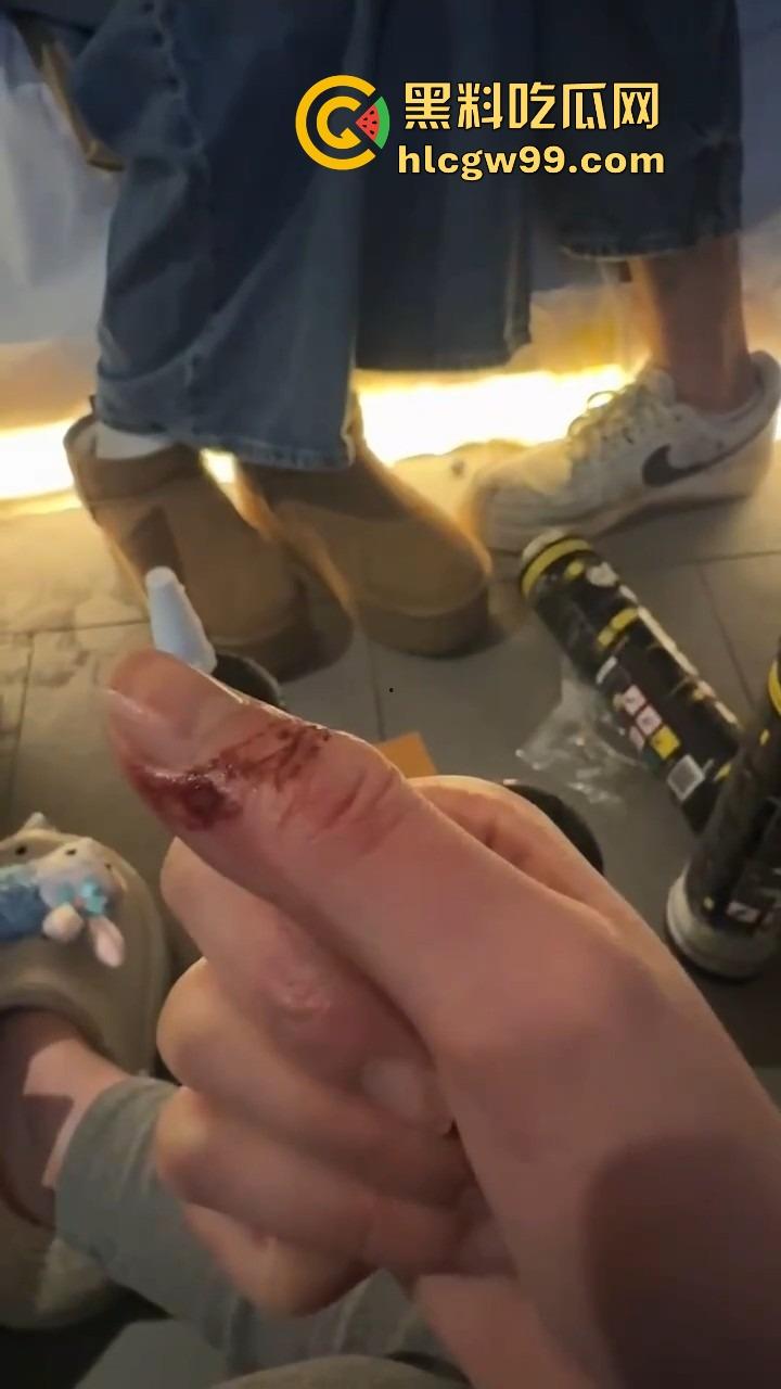 伦敦留学生与卖家交易气球因迟到大战,气球买卖差点变搏击赛,现场手指流血画面曝光!-9