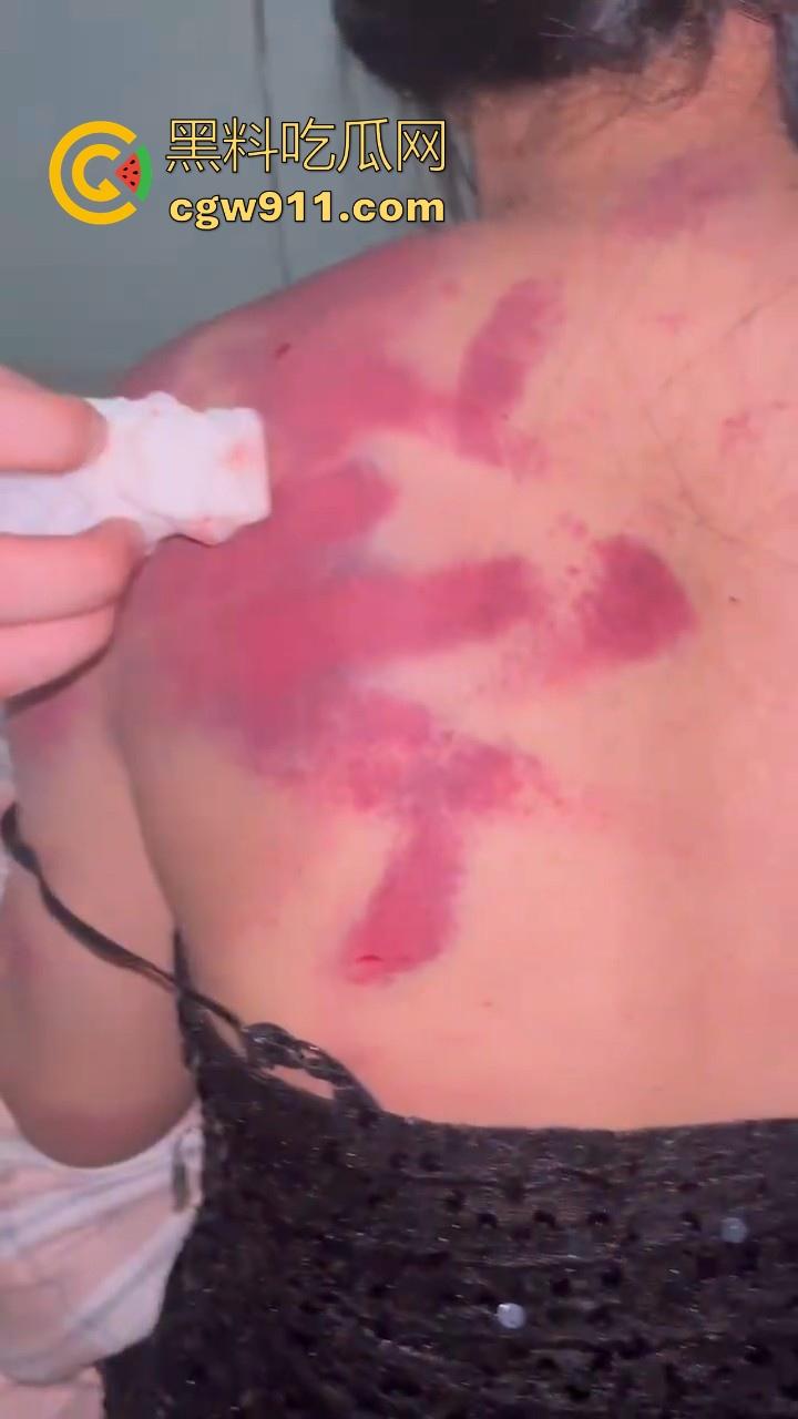 广西精神出租房围殴霸凌敌对小太妹,棍棒齐上,拳打脚踢,脱下衣服伤痕累累,战斗力丝毫不输男的!-8