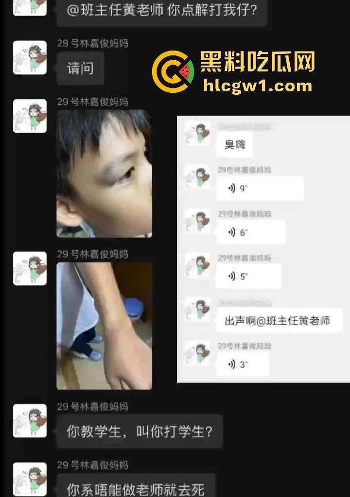 广州金隆小学曝惊天丑闻!初中学生遭体罚虐待,遍体鳞伤,家长被辱骂怒火中烧!-10