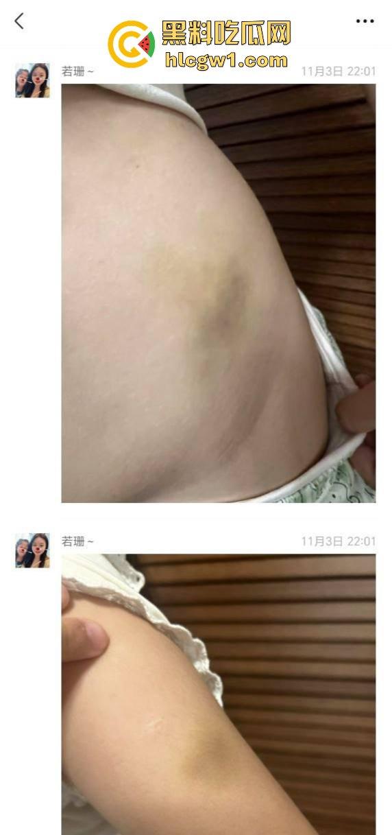 广州金隆小学曝惊天丑闻!初中学生遭体罚虐待,遍体鳞伤,家长被辱骂怒火中烧!-11