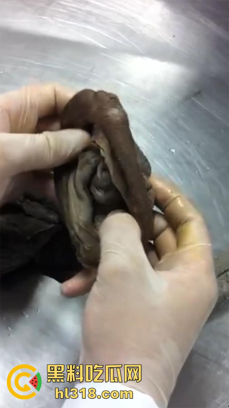 真实西藏密宗法器“肉莲花”,少女被108罗汉轮奸后,五毒侵蚀九蒸九炼,活体切割才可肉莲大成!-2