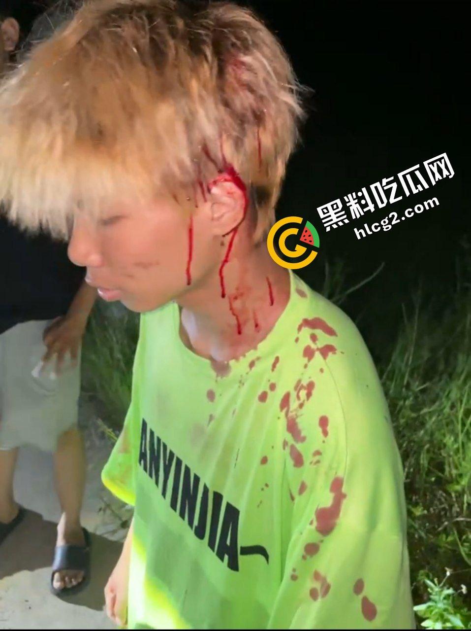 广西南宁精神小伙打架斗殴 铁棍抽打黄毛头 狂砸小毛驴 头破血流后仓皇逃走-9