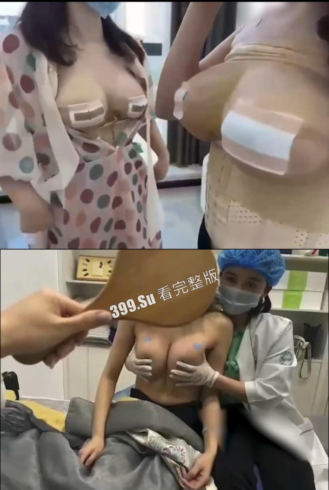 医美整形那些事儿 假的真不了  女人对自己真狠 阴唇黑了就直接切掉 （二）-4