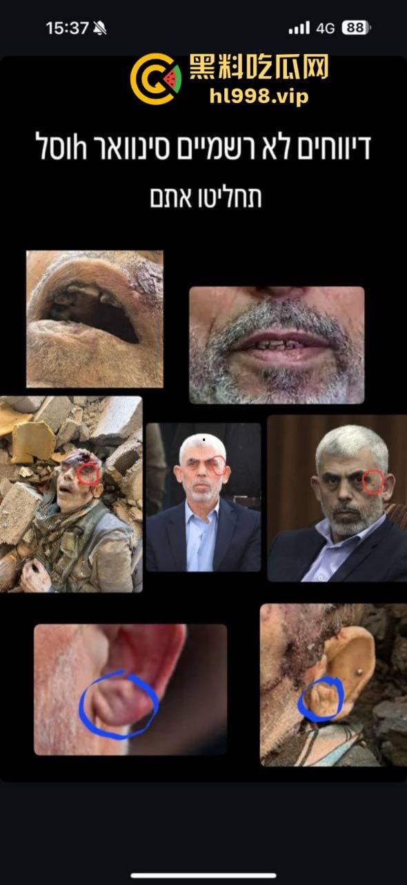 慎入！！！哈马斯领导人辛瓦尔被以方爆头击毙 遗体照片流露不忍直视！-1